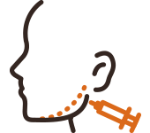 보톡스 시술 과정 이미지